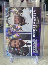 2021-22 UD - MVP Hockey - Before and After - Aaron Ekblad #BA-20- FREE SHIPPING