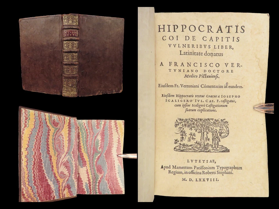 1578 HIPPOCRATES Head Wounds Greek Medicine Surgery Infant Nursing RARE 4in1 - Image 4 of 4