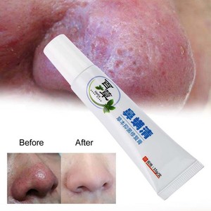 Rosacea Treatment Cream Nose Redness Removal Anti ...