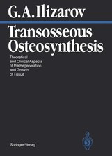 Transosseous Osteosynthesis Gavriil A. Ilizar...