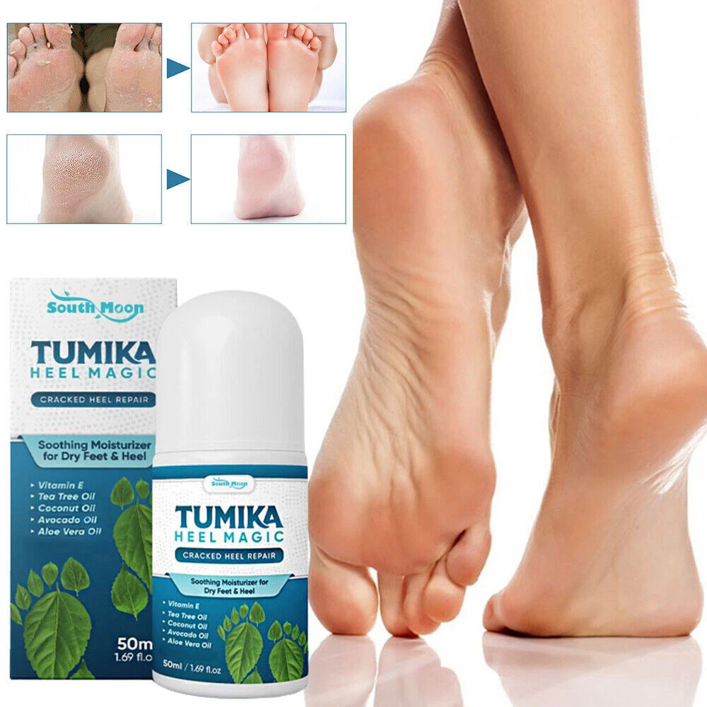 Good cream for store cracked heels