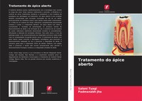 Saloni Tyagi (U. A.) | Tratamento Do áPice Aberto | Taschenbuch | Portugiesisch