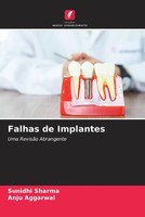 Sunidhi Sharma (U. A.) | Falhas De Implantes | Taschenbuch | Portugiesisch