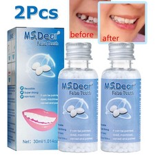 2x Tooth Repair Kit - Temporary Filling Beads for Broken,Chipped Missing Teeth