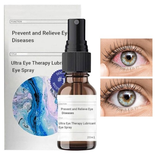 Augenspray für trockene Augen. Natürliches, schmierendes Augenspray. Trockene - Bild 3 von 12