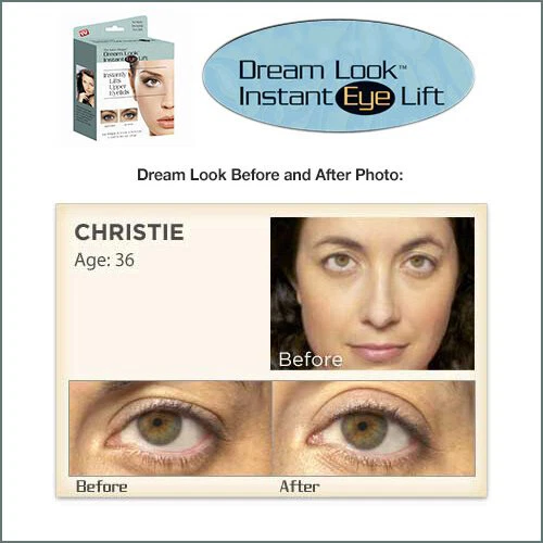 Dream Look Instant Eye Lift for Droopy, Saggying, or Hooded Eyelids - Image 3 of 4