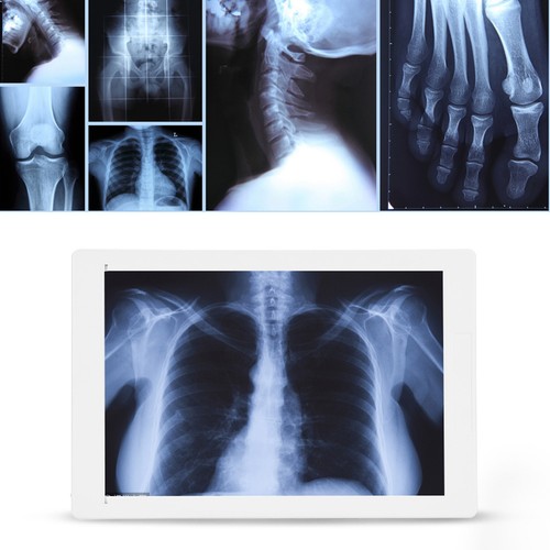 EU Plug AC 100240V LED XRay Viewer Illumination With High Brightness 36cmx24cm - Picture 7 of 12