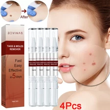 4X Common and Plantar Moles-Off Wartsoff Remover, WipeOff Tags&Moles Remover NEW