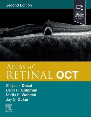 Atlas of Retinal Oct : Optical Coherence Tomography, Hardcover by Duker, Jay ...