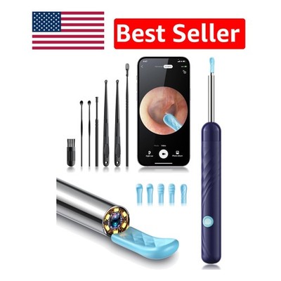 Professional Ear Wax Cleaner with 1080P Camera & LED Light - Safe and Effective