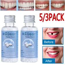 5/3x Tooth Repair Granules Temporary Tooth Repair Kit Fitting Beads Reusable US