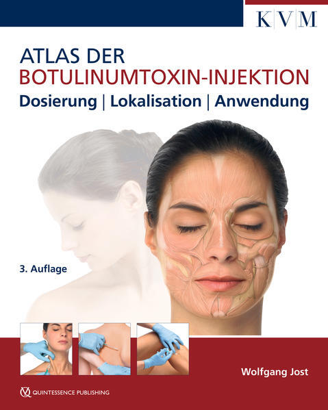 Thumbnail - Atlas Der Botulinumtoxin-injektion | Wolfgang Jost | 2018 | Deutsch