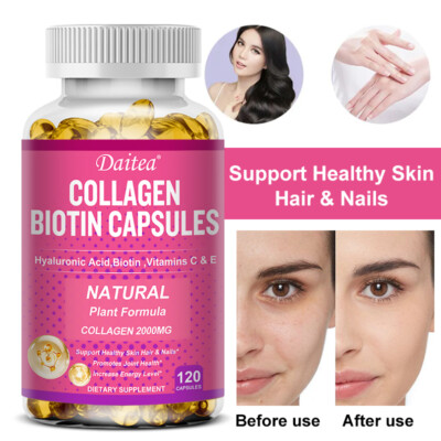 Collagen Biotin Capsules Improves Skin Radiance Elasticity And Moisture 120 Ct