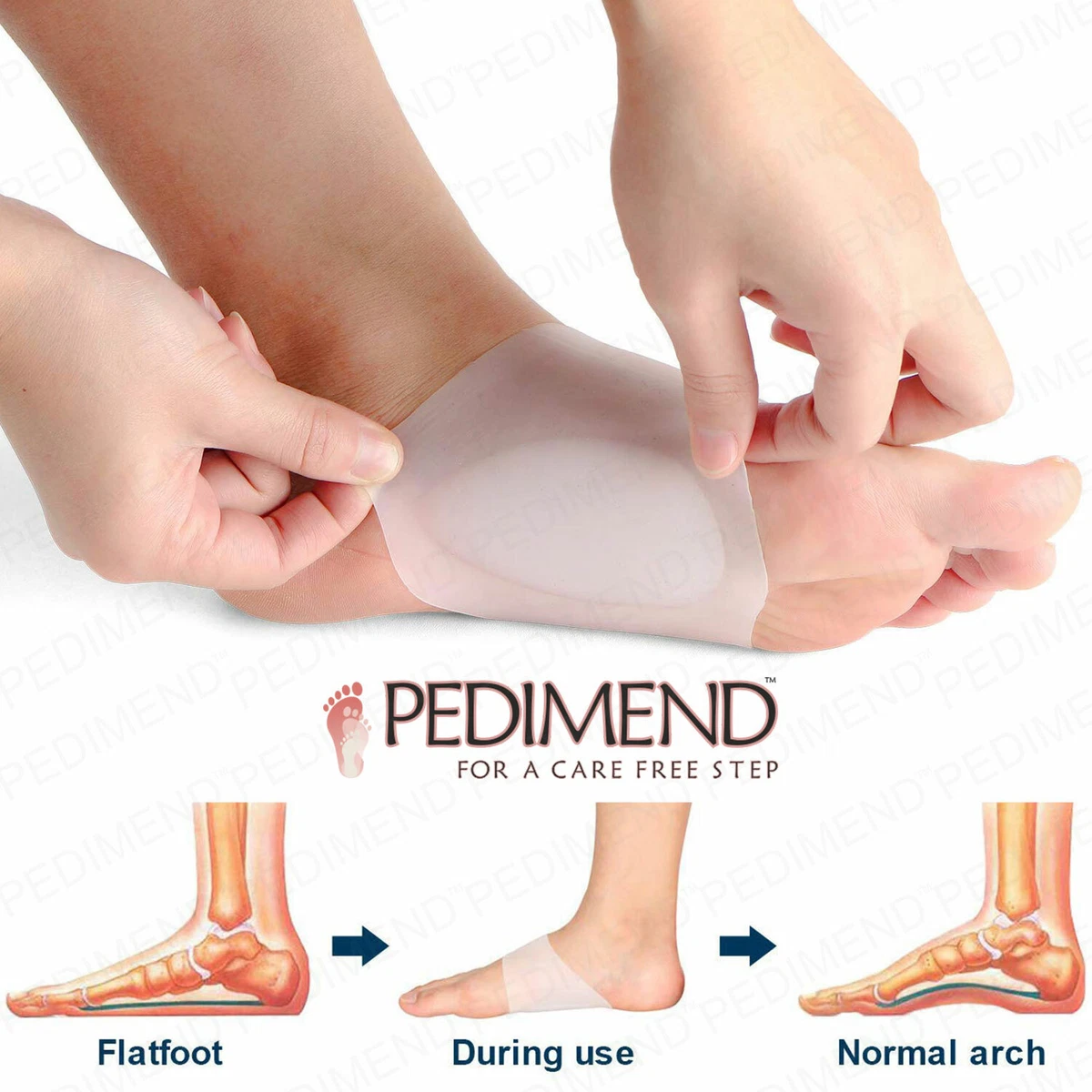 Pedimend Arch Support Gel Pads for Plantar Fasciitis, Flat Feet (2 PCS) -  UNISEX