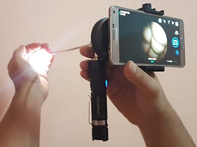 ClaraMed phone endoscope adapter with LED light source compatible with Storz. S2