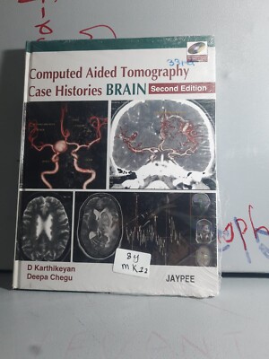 Computed Aided Tomography Case Histories BRAIN 