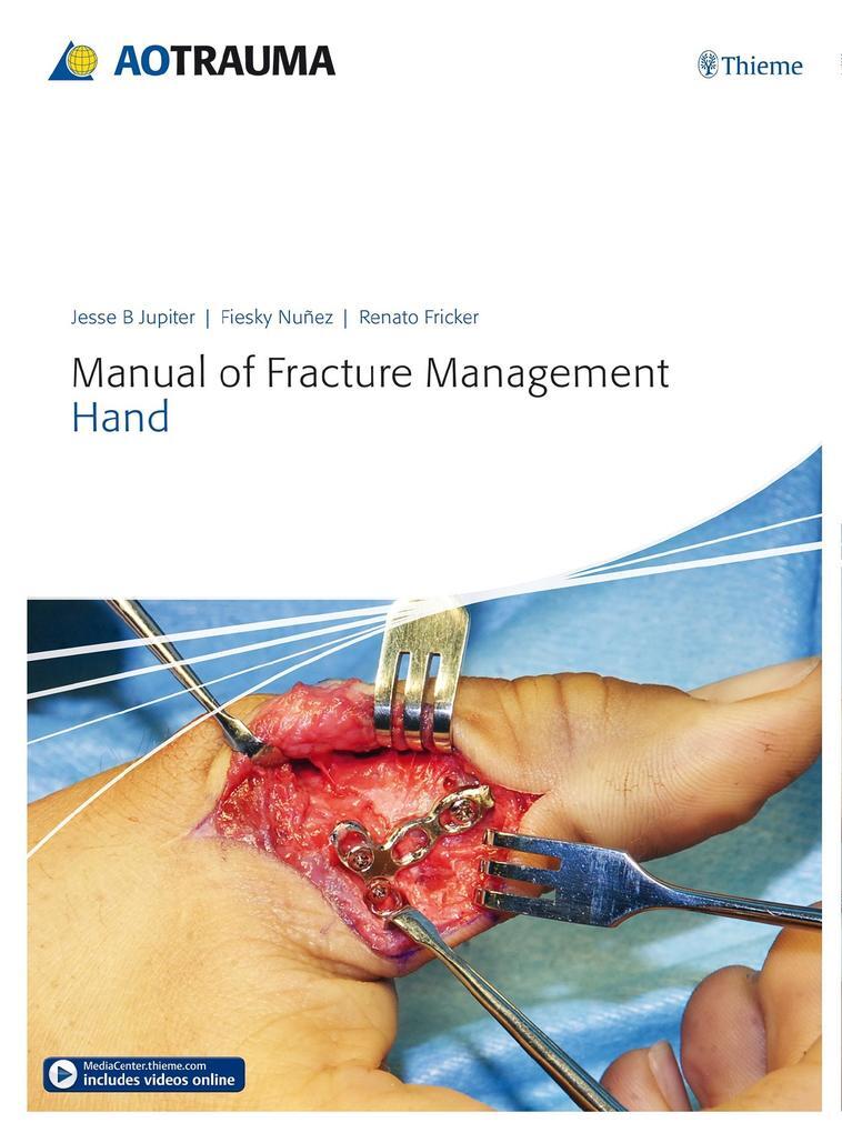 Thumbnail - Manual Of Fracture Management - Hand | 2015 | Englisch