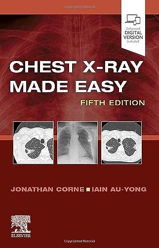Chest X-Ray Made Easy Corne Au-Yong Paperback 9780702082344 5e - Image 5