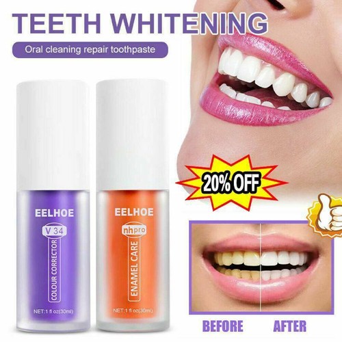 v34 whitening