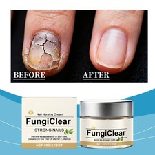 FungiClear Nail & Toenail Care Cream, Phrena ...