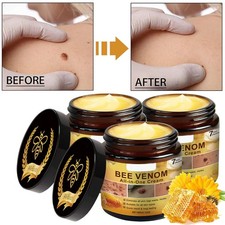 Bee Venom Skin Restoration Cream, Professional Bee Venom Skin Treatment Cream US