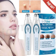 Skin Tag Remover, Tag and Spot Eraser,Skin Tag Dark Spot Remover HOT