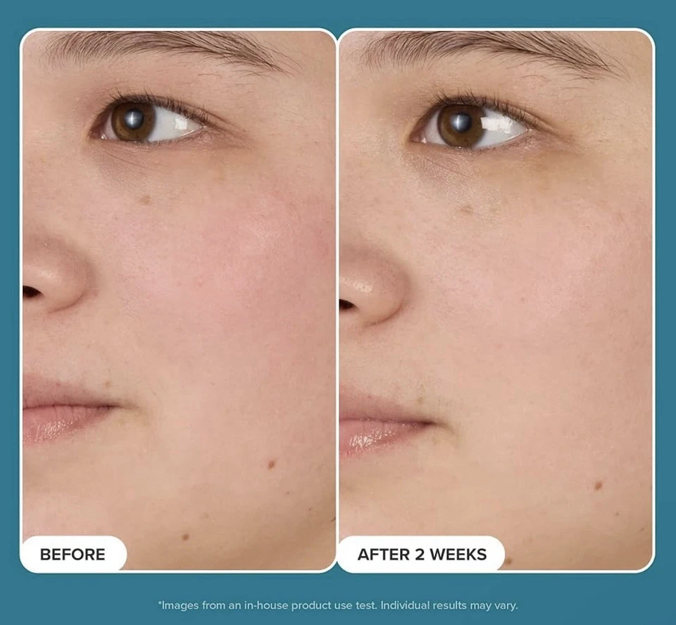 Tónico facial reductor de poros con niacinamida Paula's Choice SKIN BALANCING, para aceite Foto 3 de 4