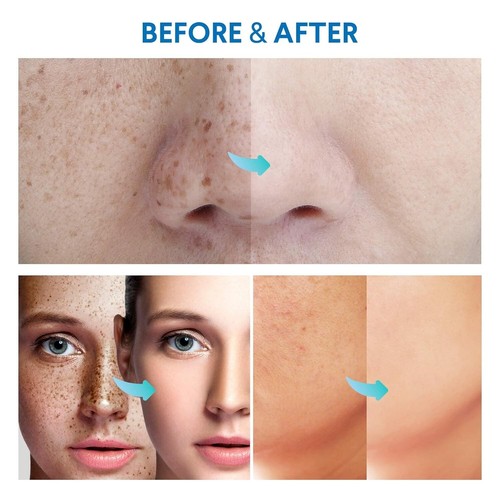 Razor Bump Stopper with Ingrown Hair Treatment Razor Bumps Treatment for Men ... - Picture 7 of 7