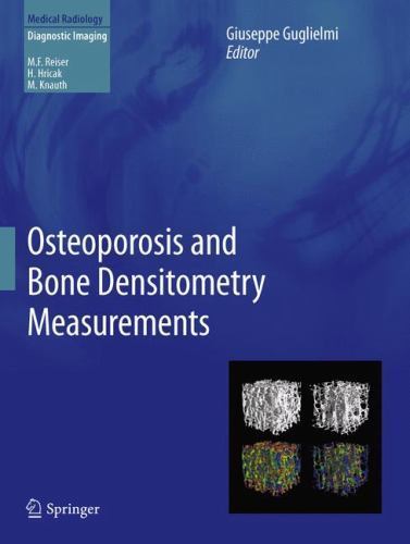 Medical Radiology Ser.: Osteoporosis and Bone Densitometry Measurements by ...