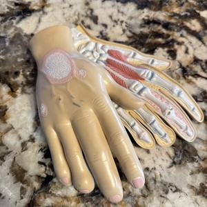 Enbrel Psoriasis Hand Muscles Bones Ligaments Anatomical Model Anatomy