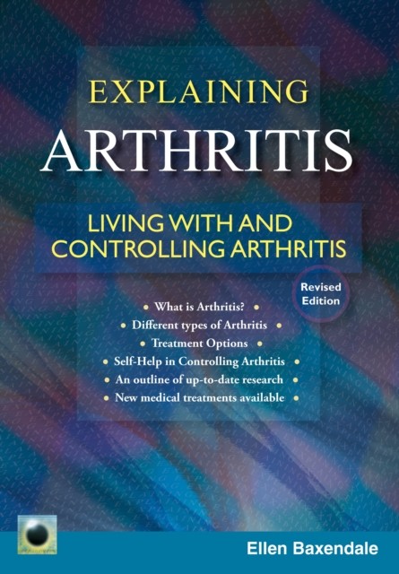 An Emerald Guide to Explaining Arthritis by Ellen Baxendale (Paperback Book)