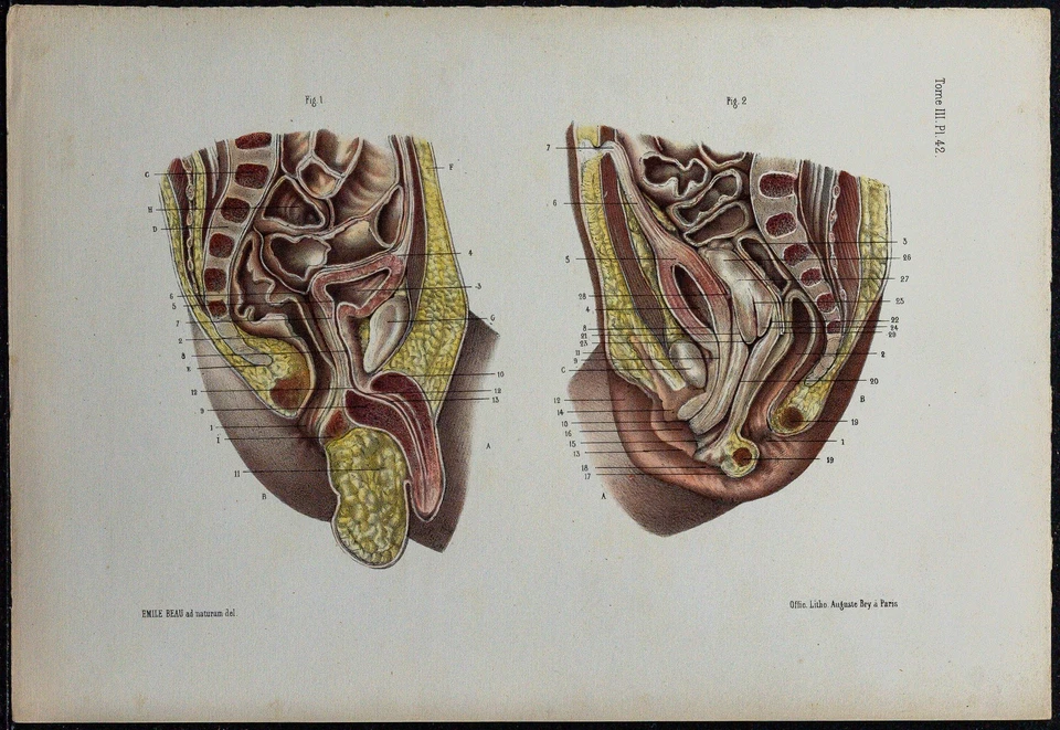 1866 - Basin & Bodies Pelviens Néonataux - Anatomy & Paediatric - engraving