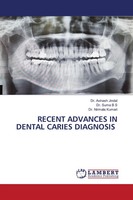 Avinash Jindal (U. A.) | Recent Advances IN Dental Caries Diagnosis | Buch