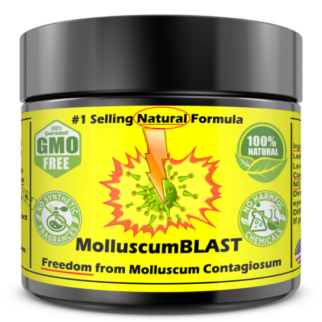 Molluscum Contagiosum Treatment Cream LARGE 60 ml Kids Adults 100% SAFE &NATURAL