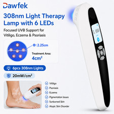 308nm Narrowband UVB Phototherapy Device 6 Diodes 20mW/cm for Skin Disorders