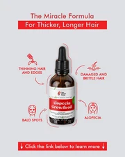 Lise Alopecia Hair Growth Oil | Castor + 20 Natural Oils | Fast Results Serum