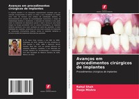Rahul Shah (U. A.) | AvançOs Em Procedimentos CirúRgicos De Implantes | Buch
