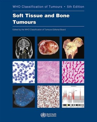 WHO classification of tumours of soft tissue and bone tumours by World Health Or
