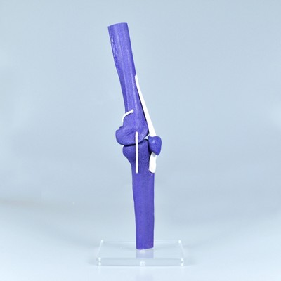 1/2 size Knee joint,Articulated, Orthopedic practice model Simulated sawbone