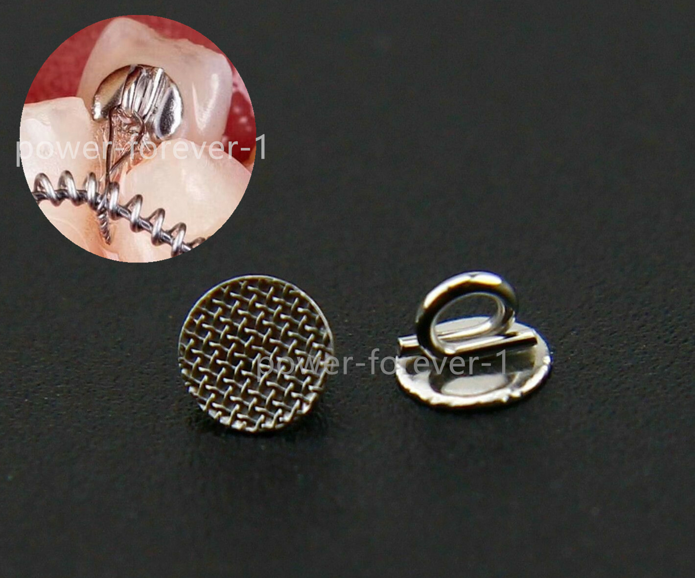 Dental Eyelet Round Direct Bond Brackets Orthodontic Wires Traction Resistance eBay