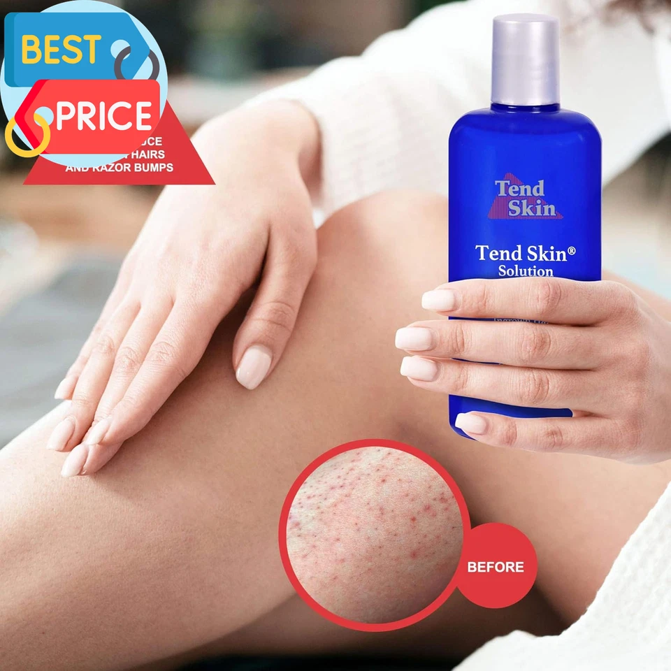 Care Solution, Unisex, 16 Fl. Oz - Image 4 of 4