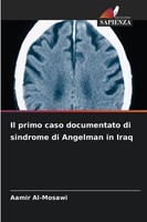 Il Primo Caso Documentato Di Sindrome Di Angelman In Iraq Aamir Al-Mosawi