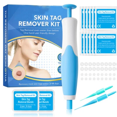 WISSP Natural Painless Auto Skin Tag Removal Kit Skin Tag Micro Bands Remover Device