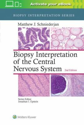 Biopsy Interpretation of the Central Nervous System, Hardcover by Schniederja...