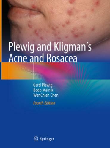 Thumbnail - Plewig And Kligman´s Acne And Rosacea 3474