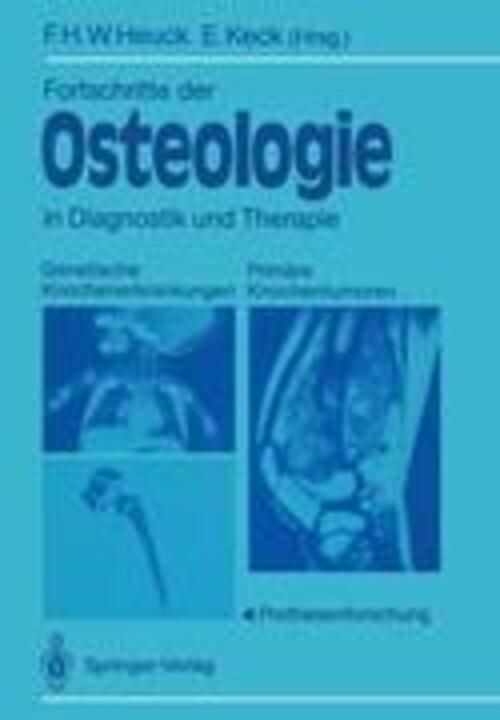 Thumbnail - Fortschritte Der Osteologie In Diagnostik Und Therapie Elmar Keck (u.