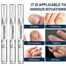 15 Pack Lunavia Antifungal Pen, 25 Undecylenic Acid Toenail Fungus Treatment