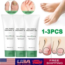 Nutraboost Nail Fungus Treatment Gel, Nail Fungus, Fungus Cream (1-3PCS)