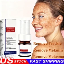 Effective Whitening Freckle Cream Remove Dark Spot Cream Removal Melanin Melasma
