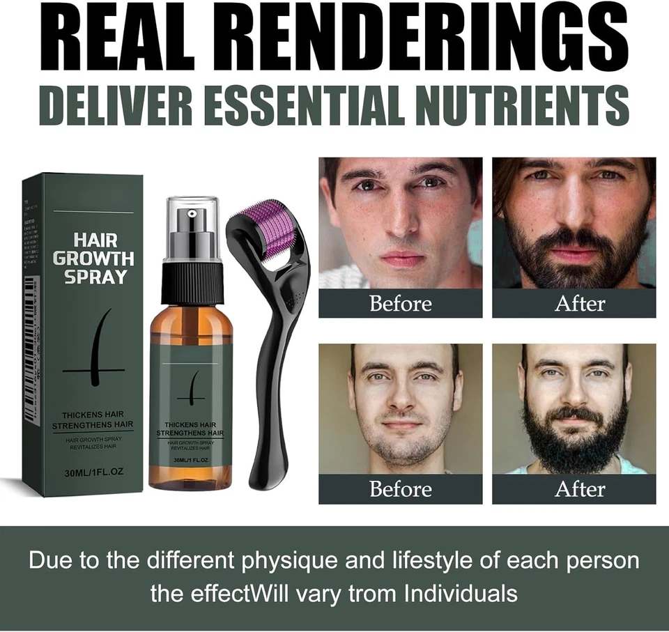 Huile Barbe 30Ml, Kit Spray Hydratant, Soin Homme, Qualité Supérieure Bio, Pour  - Photo 4/4